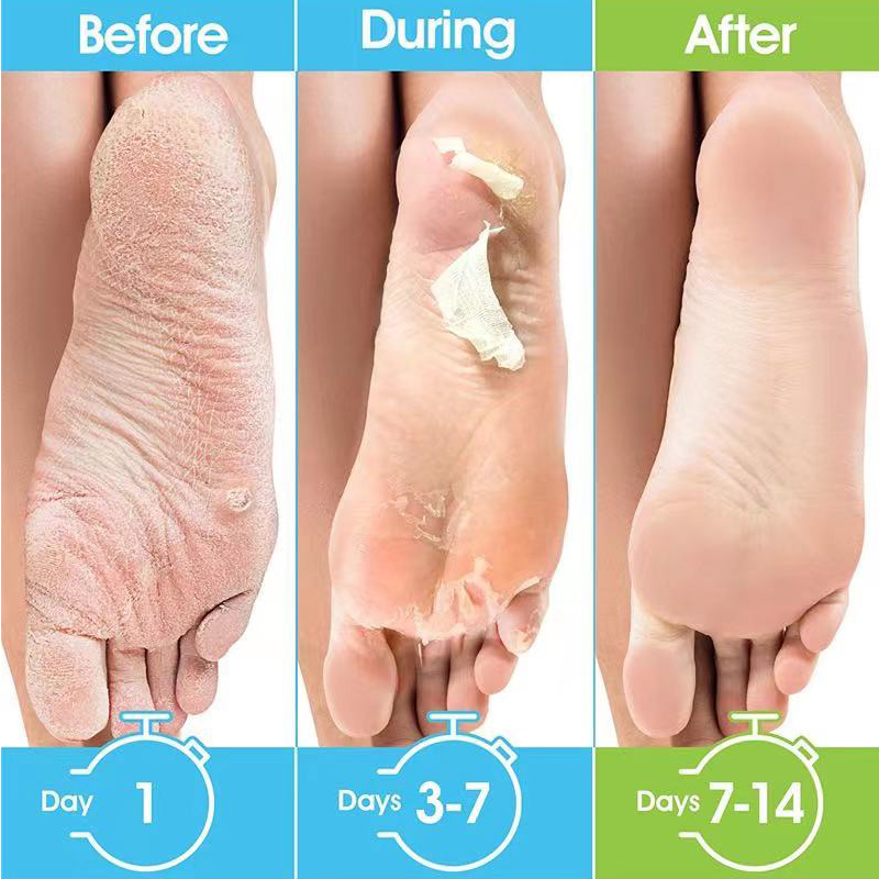 1 paire = 1 masque pour les pi - Foot Mask Peeling avis et prix