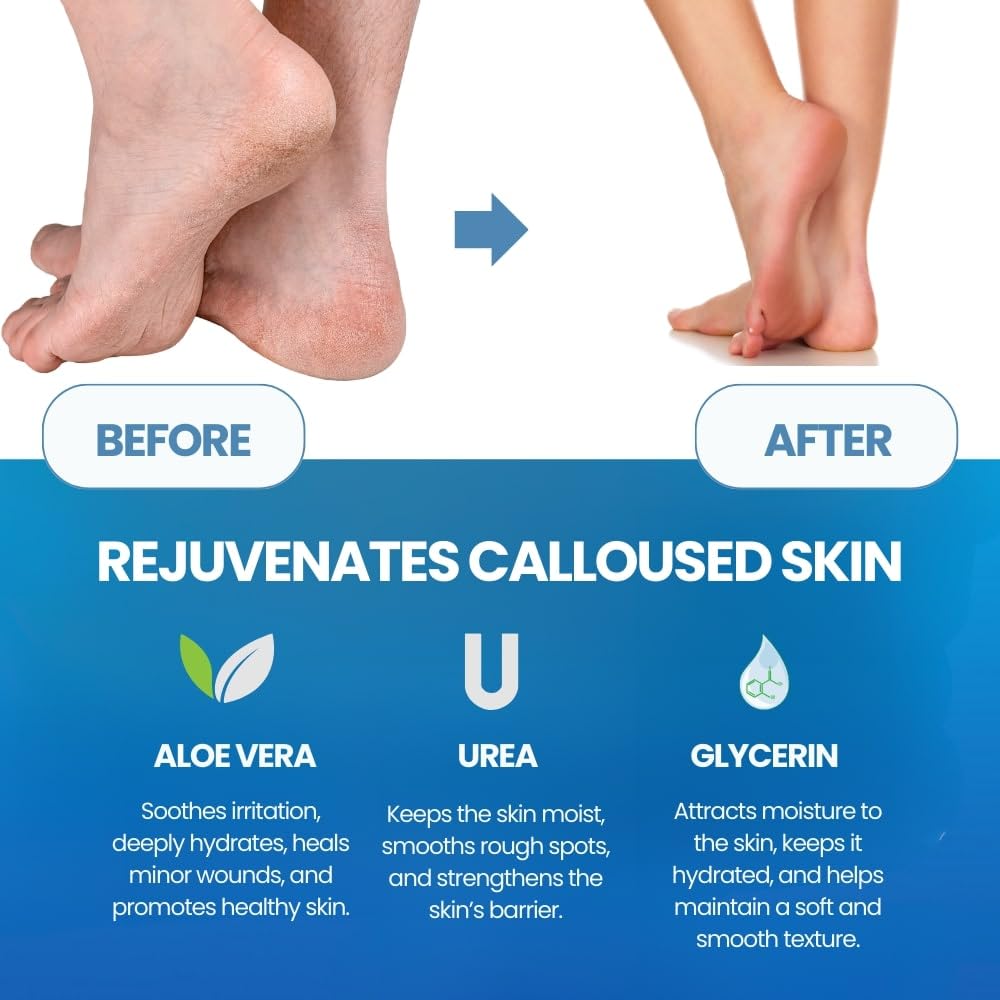 Masque Exfoliant et Adoucissan - Foot Mask Peeling avis et prix