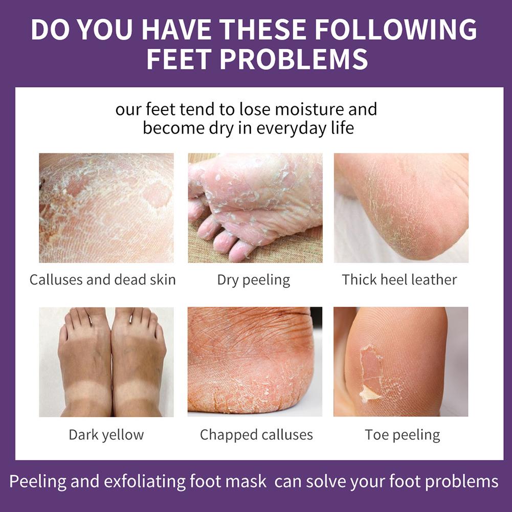 Masque pour les pieds à l'esse - Foot Mask Peeling avis et prix