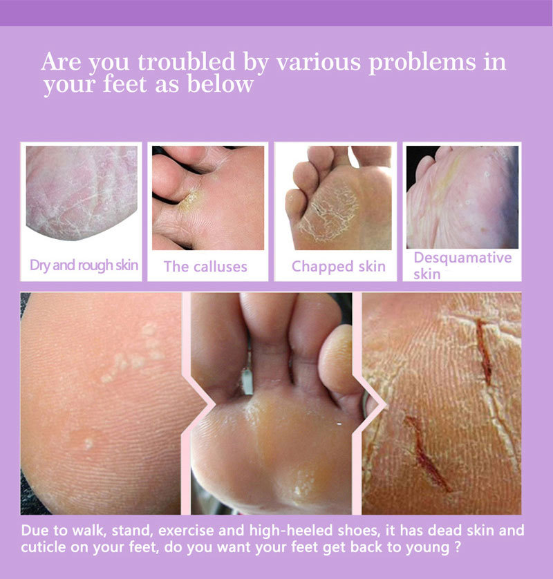 Masques exfoliants pour les pi - Foot Mask Peeling avis et prix